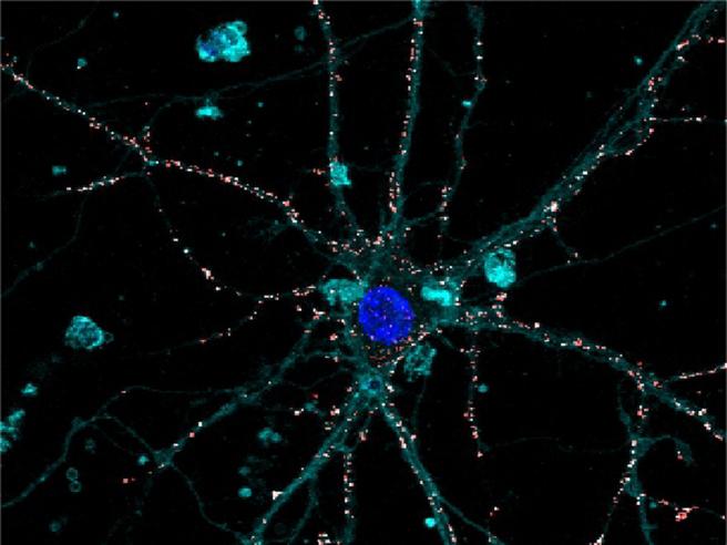 Liquid prosthesis for artificial retina