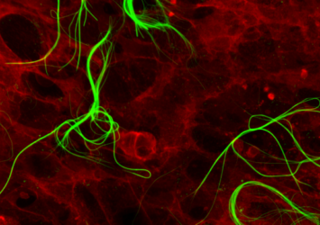 Thiophene-based polymorphic nanostructures in living cells.