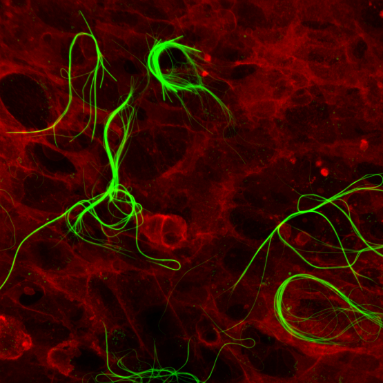 -Fibers interconnecting living cells-