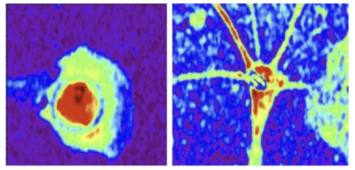 Advanced Imaging Technique to define healthy and diseased astrocytes